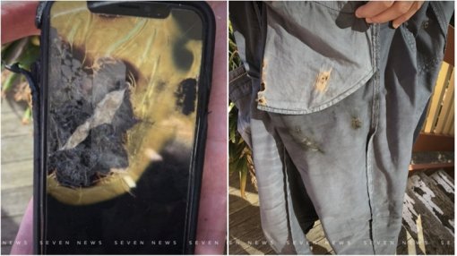 iPhone X взорвался в кармане пользователя и привел к ожогам ноги второй степени